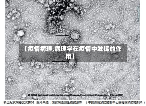 【疫情病理,病理学在疫情中发挥的作用】